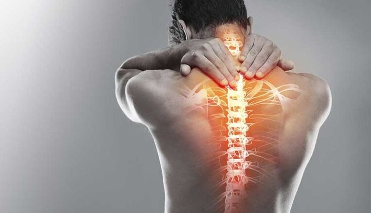Durere severă în mijlocul spatelui - un semn de deteriorare a coloanei vertebrale