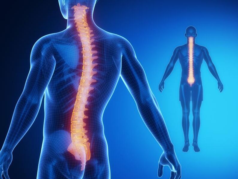 Osteocondroza coloanei vertebrale, care necesită tratament complex