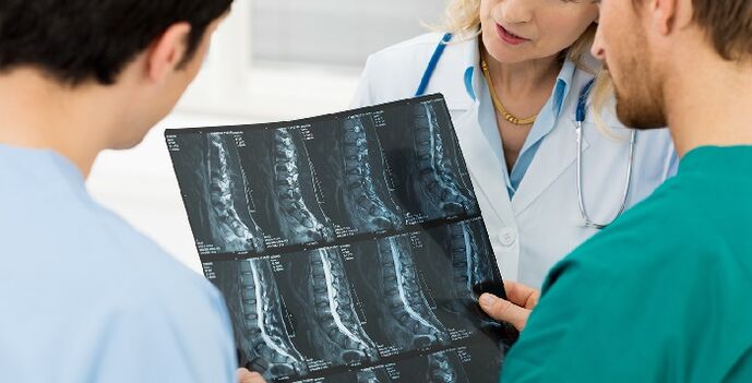 Radiografia coloanei vertebrale ca modalitate de diagnosticare a osteocondrozei