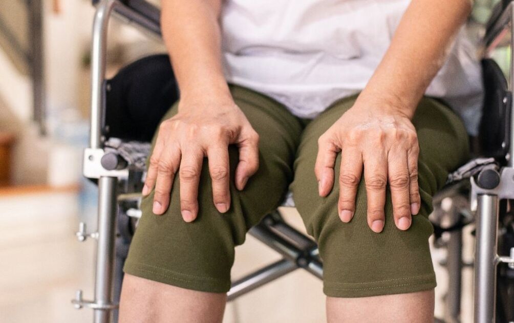 Un pacient cu artroză a articulațiilor genunchiului