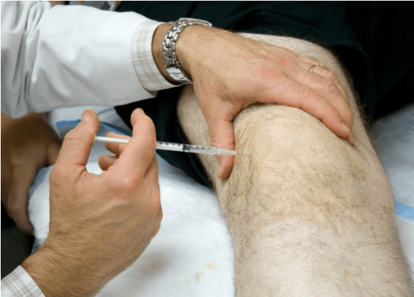 Administrarea intraticulară a analgezicilor în dureri severe